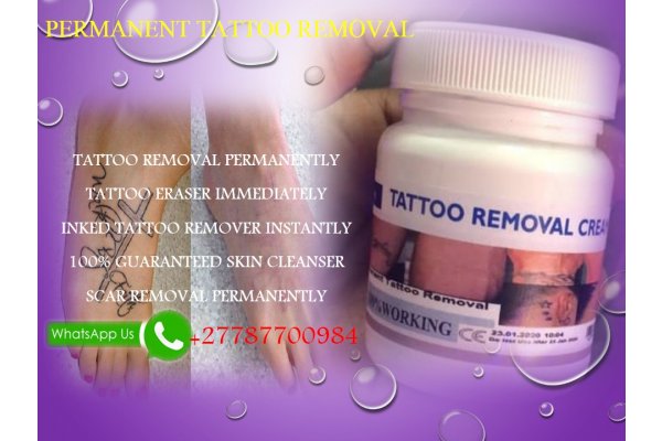 PERMANENT_TATTOO_REMOVAL__gallery.jpg